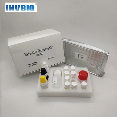 Медицинский набор MSDS Kit Test Elisa Rapid Diagnostic T3 T4 HIV HBsAg CA PSA AFP