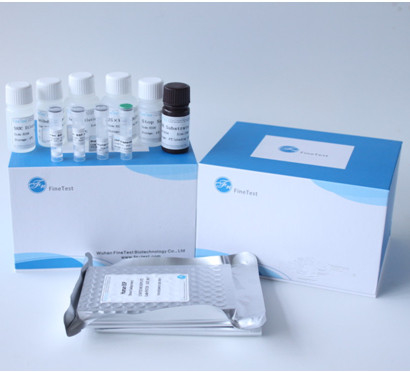 Набор Assay биохимического набора человеческий 96T Elisa обнаружения HCV Elisa